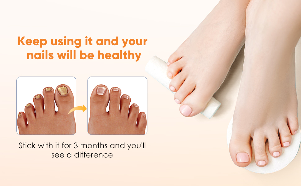 keep using it and your nails will be healthy